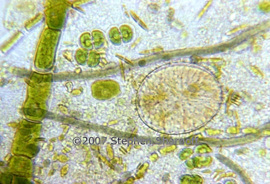 algal cells 2 graphic