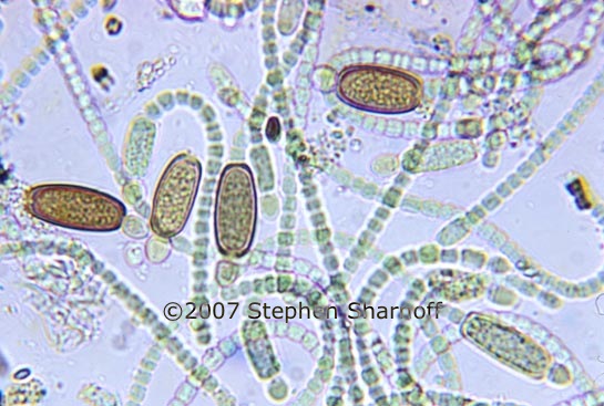 cylindrospermum cells graphic